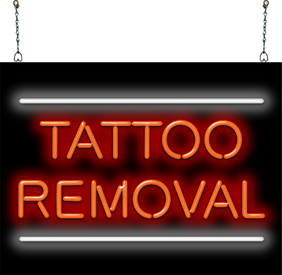 Tattoo Removal Neon Sign